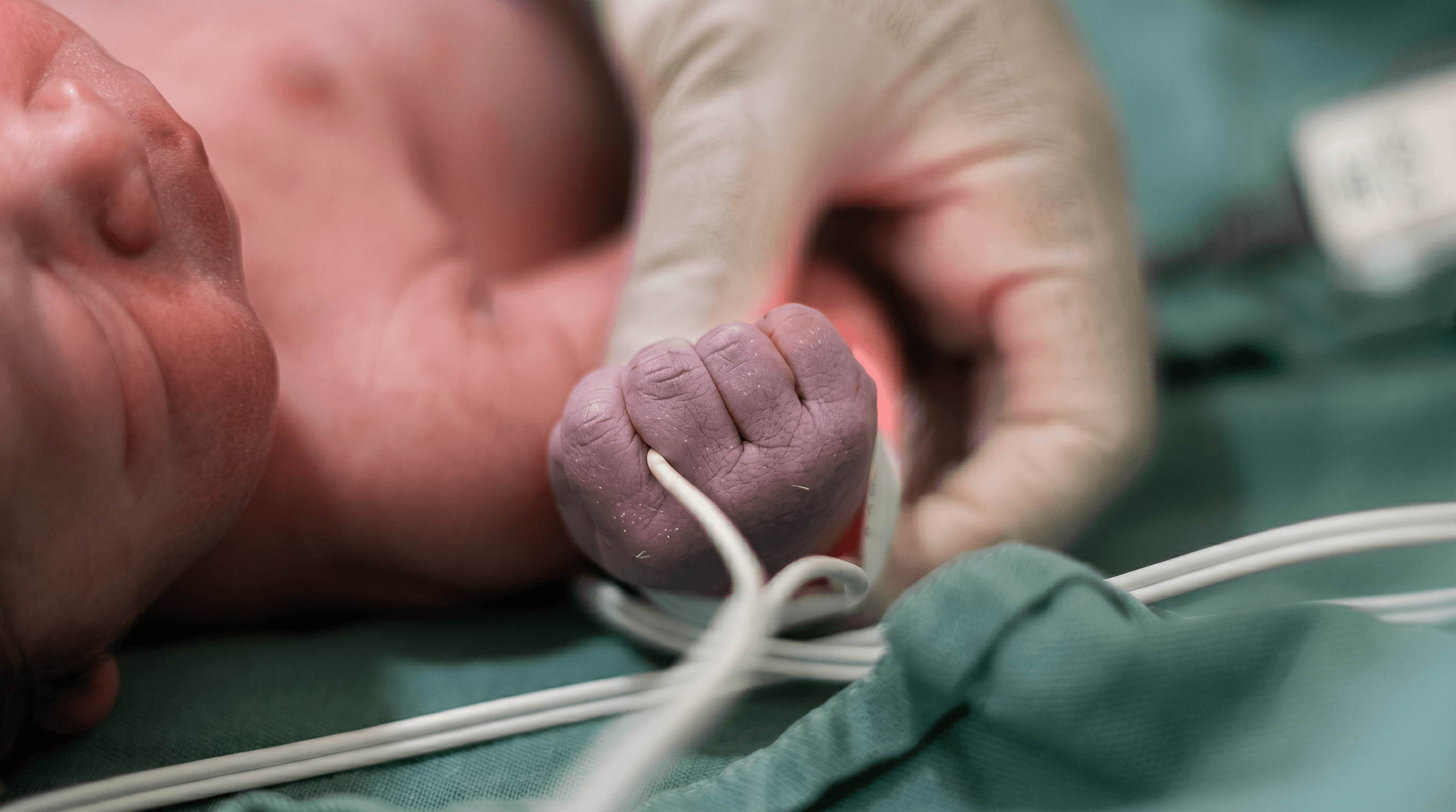 Cirugía Neonatal