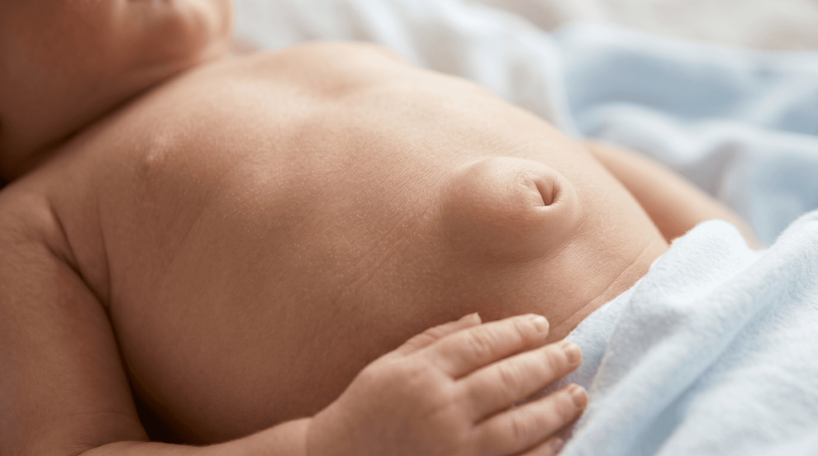 Hernia Umbilical Pediátrica